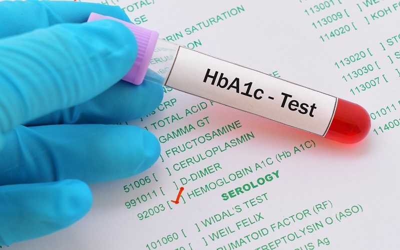 A1C